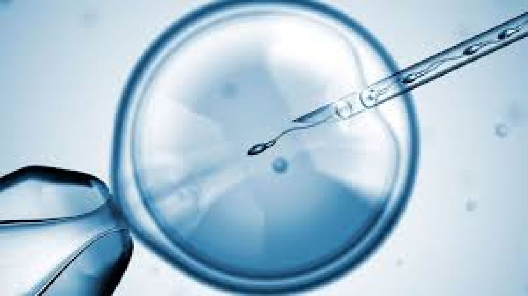 Fertilización asistida