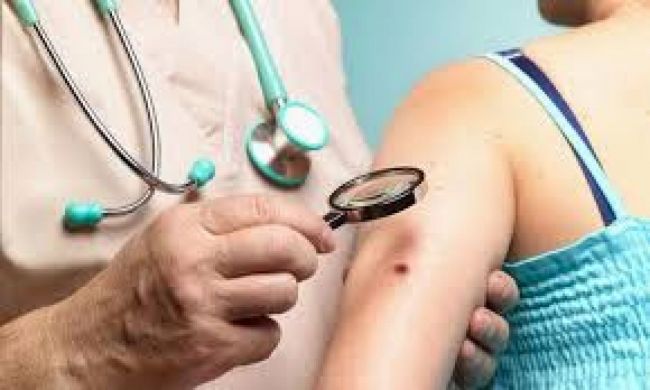 Campaña contra el cáncer de piel