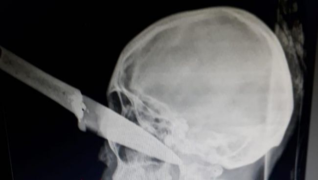 La tremenda lesión, cuyas imágenes se viralizaron