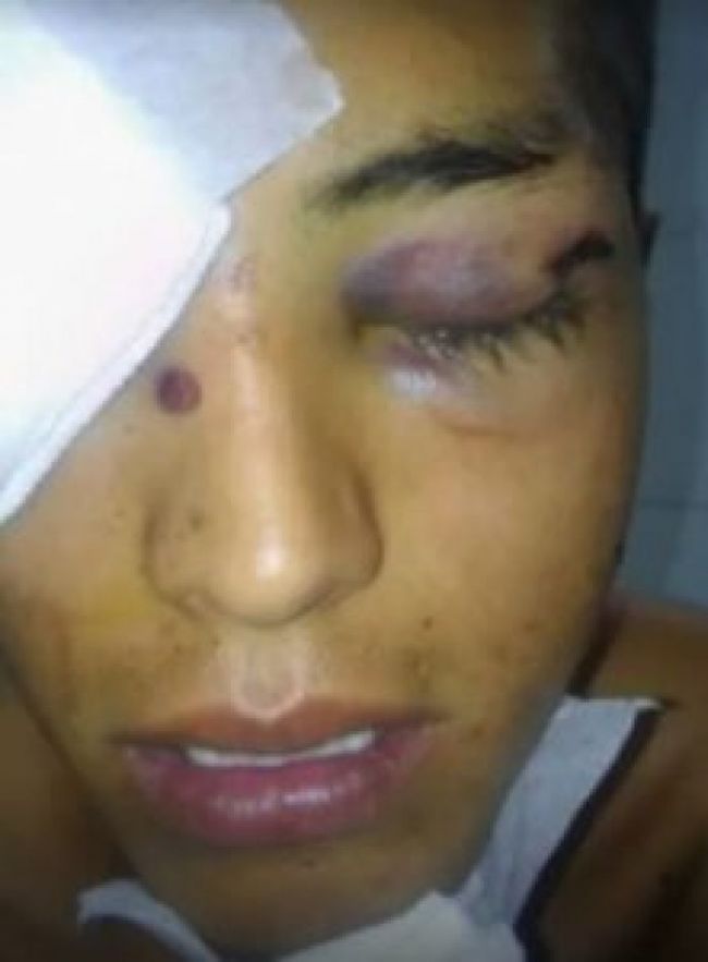 En una de las causas un joven perdió un ojo