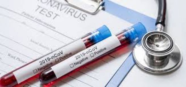 Salud reporta 30 fallecidos hasta la fecha