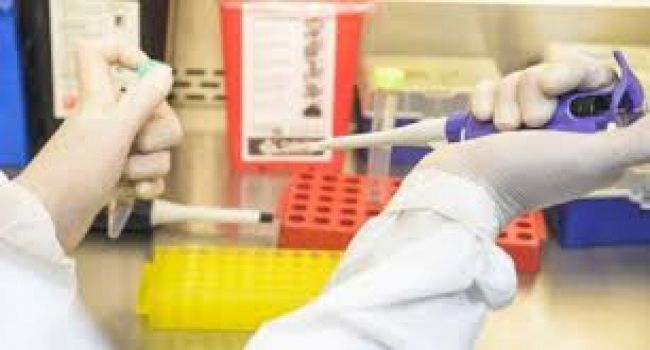 Hay 97 personas con asistencia respiratoria mecánica