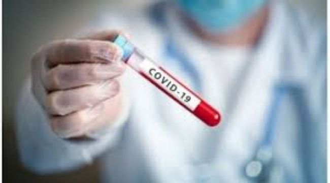 Argentina pasó el millón doscientos mil casos