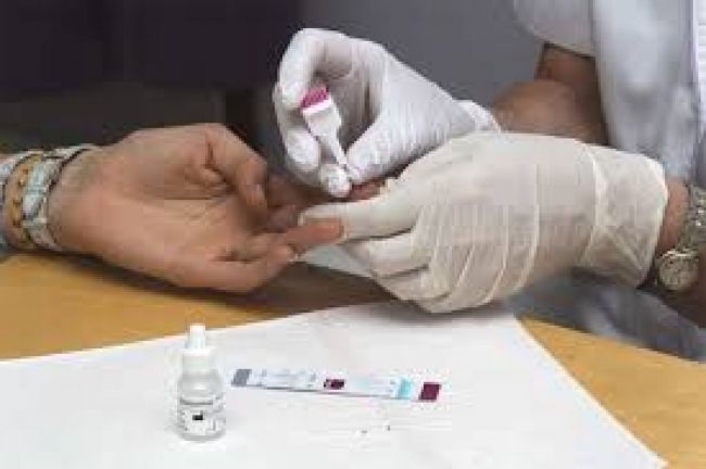 Test de HIV