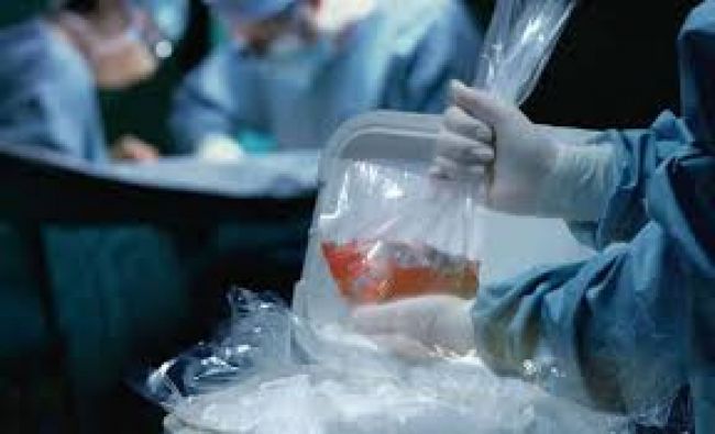 Otros 2541 pacientes esperan algún tejido