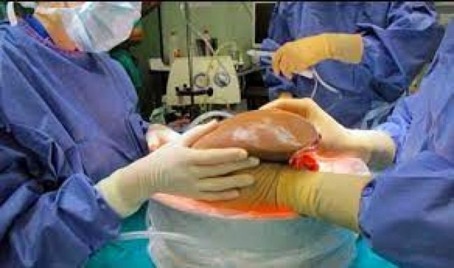 Donar órganos salva vidas