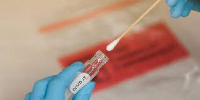 Sin testeo para contactos estrechos