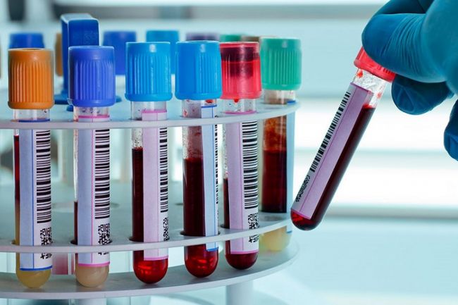 En Salta hay 5 pacientes con asistencia respiratoria por Covid