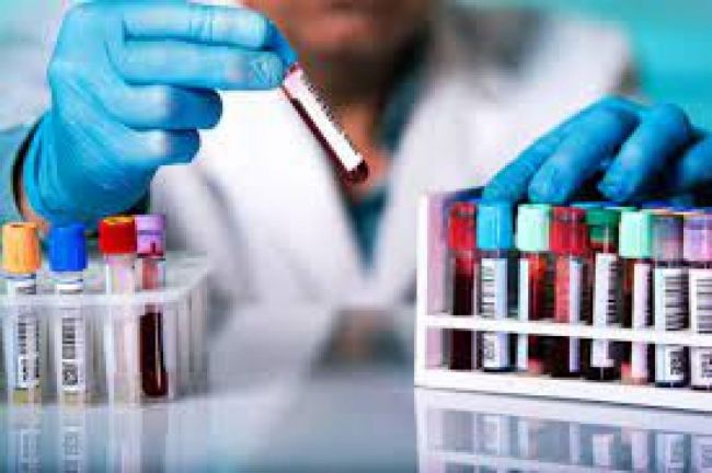 Reporte semanal de Covid