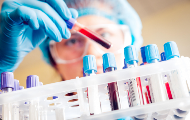 Caso de dengue confirmado