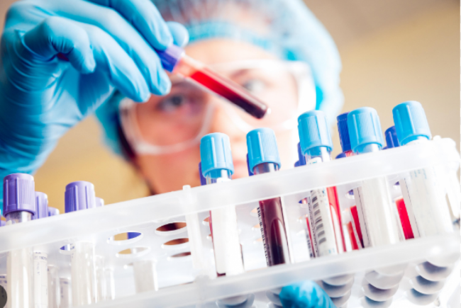 Se reportaron 21 casos de Covid