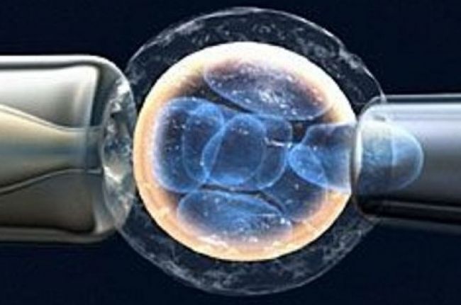 Fertilización asistida