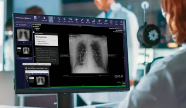 IA en el hospital público