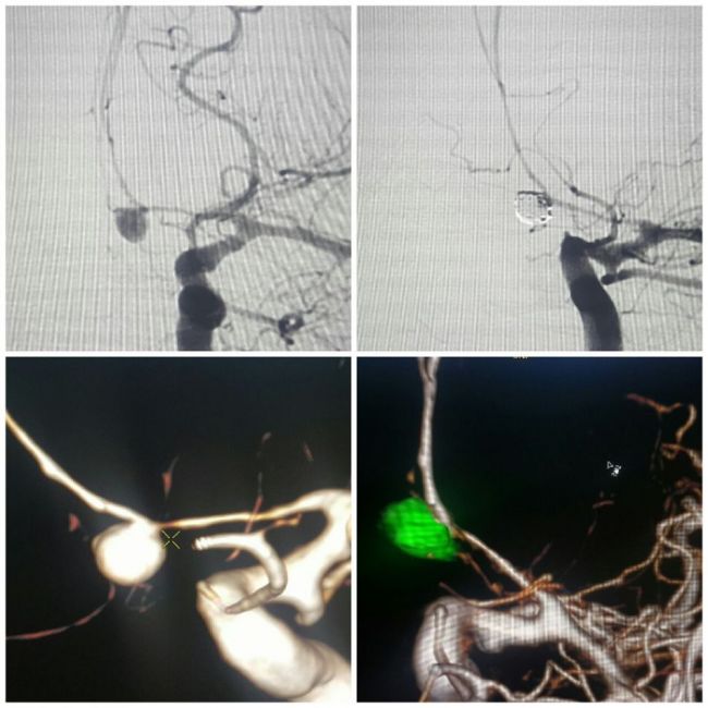 Detalle del procedimiento realizado