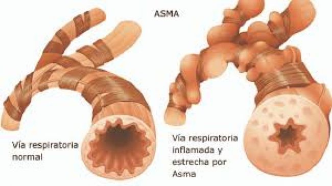 Imagen ilustrativa