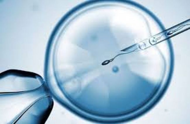 Fertilización asistida